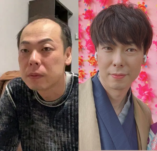 竹之内社長のウィッグ