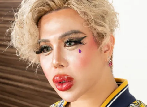 行き過ぎた美容整形