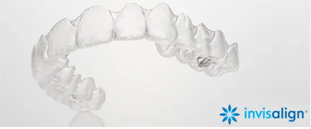 インビザライン