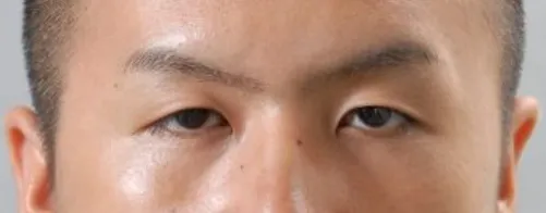 目が小さい・目つきが悪い